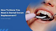 How To Know You Need A Dental Crown Replacement? - AtoAllinks
