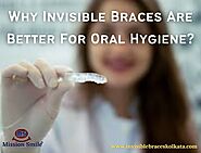 Why Invisible Braces Are Better For Oral Hygiene?