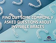 Find Out Some Commonly Asked Questions About Invisible Braces