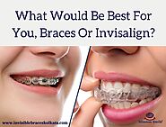 What Would Be Best For You, Braces Or Invisalign?
