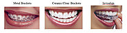 Best Orthodontist in Sector 23 Noida, Orthodontic Specialist