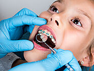 Orthodontist Singapore - Garden Dental