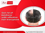 Know About Non-Surgical Hair Transplant | by Dr paul's online | Sep, 2022 | Medium