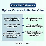 Spider Veins vs. Reticular Veins