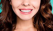 Which Teeth Whitening Method Should I Choose?