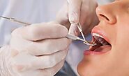 The Ultimate Guide to Finding the Best Dentist in Winchester