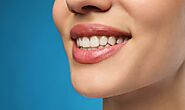 Winchester Cosmetic Dentistry: Enhancing Your Smile’s Natural Beauty