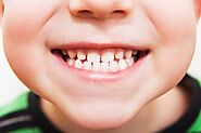 All About Pediatric Restorative Dentistry And Its Procedures