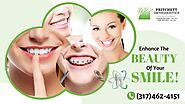 Have a Better Smiles with Traditional Braces