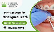 Treat Your Dental Irregularities with Orthodontist
