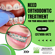 Get the Best Orthodontist to Align Your Teeth
