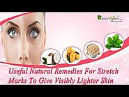 Useful Natural Remedies for Stretch Marks to Give Visibly Lighter Skin