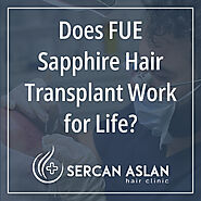 Does FUE Sapphire Hair Transplant Work for Life? - Sercan Aslan Hair Clinic