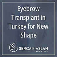 Eyebrow Hair Transplant in Turkey - Sercan Aslan Hair Clinic