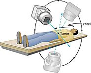 Best Radiation Oncology in Noida