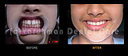 Best Dentists in Delhi, Maintain Your Dental Health