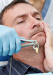 Tooth Extractions in Toronto | Tooth Extractions in Brampton & Mississauga