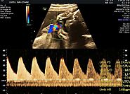 In search of The Best Clinic For Fetal Well-Being Assessment & Doppler's Test?