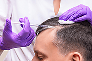 What You Should Know About PRP Injections for Hair Loss? : renewmedicalcen — LiveJournal