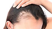 Platelet-Rich Plasma (PRP) Therapy: The Ultimate Solution To Reverse Thinning Hair |