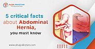 5 critical facts about abdominal hernia, you must know