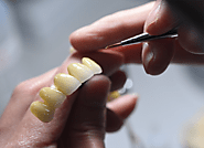 Website at https://medium.com/@chinadigitaldentallab/top-dental-laboratory-in-china-excellence-in-dental-solutions-an...