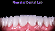 Outsourcing Dental Laboratory in China