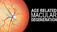 Age-Related Macular Degeneration - Symptom, Cause, Treatment