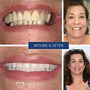 Best Teeth Whitening Port St Lucie - Great Smile Dental