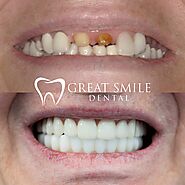 Port St Lucie Dentist |General Dentistry Port St Lucie |One Location