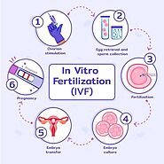 A Step-By-Step Stages of the IVF Process | by Vasundharaivf | Dec, 2022 | Medium