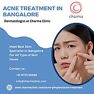 Acne Treatment in Bangalore - Charma Clinic
