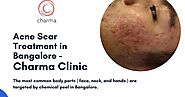 Get Effective Treatment for Atrophic Acne Scars at Charma Clinic