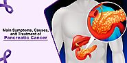 Understanding What Causes Pancreatic Cancer