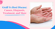 Graft Vs Host Disease: Causes, Diagnosis, Treatment, and More