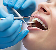 Website at https://cosmodont.com/dental-services/tooth-extractions-in-toronto/