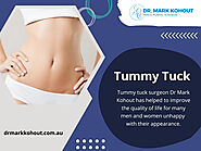 Tummy Tuck Sydney