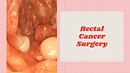 Rectal Cancer Surgeon in Chandigarh