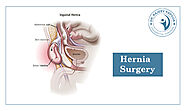 Hernia Surgeon in Chandigarh