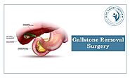 Is gallstone surgery risky? What is the recovery rate for gallstone surgery?