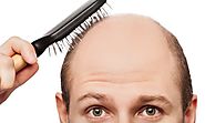Possible Cure for Baldness in Saudi Arabia