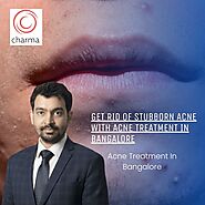 Get Rid of Stubborn Acne with Acne Treatment in Bangalore