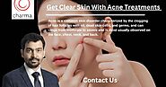 Best Dermatologist in Bangalore - Charma Clinic