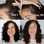 Essential Nutrition And Hair Vitamins For Postpartum Hair Loss