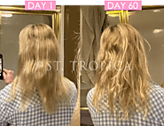 Website at https://www.sttropica.com/pages/cushing-disease-hair-loss