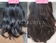 100 Day Money Back Guarantee With Best Hair Results From ST.TROPICA