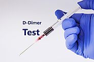 What Is D-Dimer Test - Ganesh Diagnostic