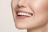 Teeth Cleaning and Whitening