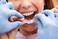 Braces and Invisalign Orthodontics Treatment