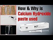 How & Why is Calcium Hydroxide paste used | Waldent RCTcal